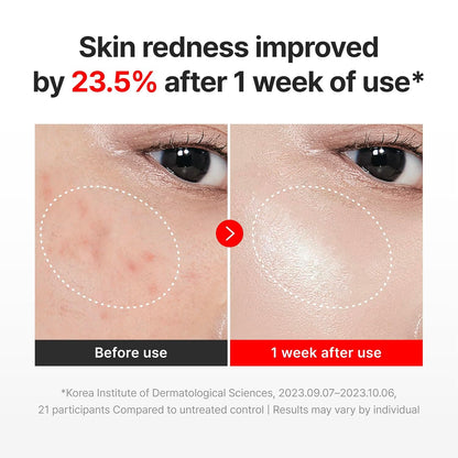 Anti-Aging Face Cream - Cica + Hyaluronic Acid Care For Wrinkles & Dry Skin