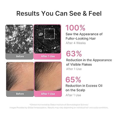 Scalp-to-Hair Strengthening Set – Thicker, Fuller Hair With Rosemary PDRN
